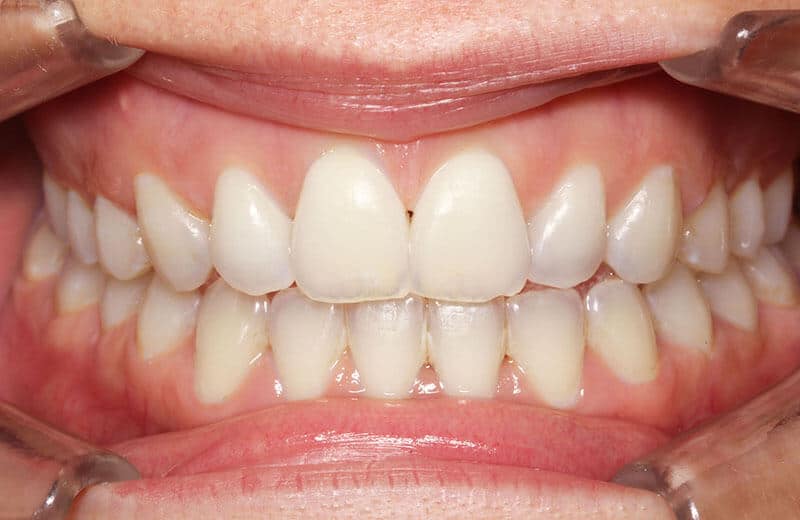 D'Ascoli Orthodontics - PatientRewardsHub.com™